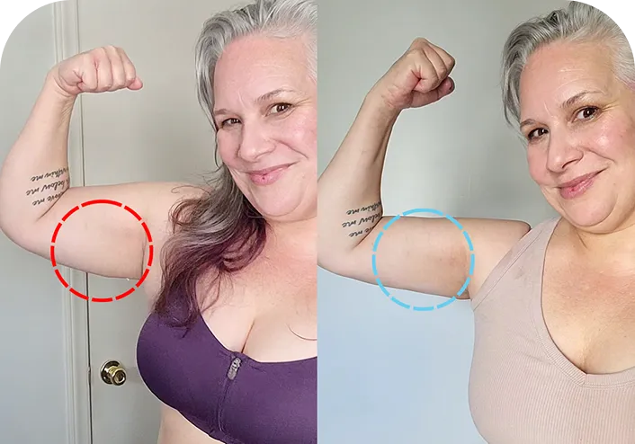 Customer arm comparison image