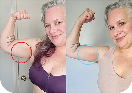 Atena arm comparison image shown before and after