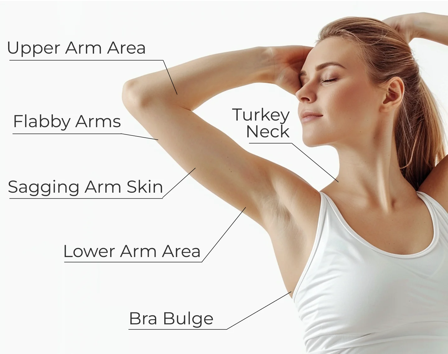 Diagram labeling areas of the upper arm and common cosmetic concerns